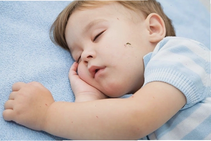Bé bị muỗi cắn là nỗi lo của nhiều bậc phụ huynh